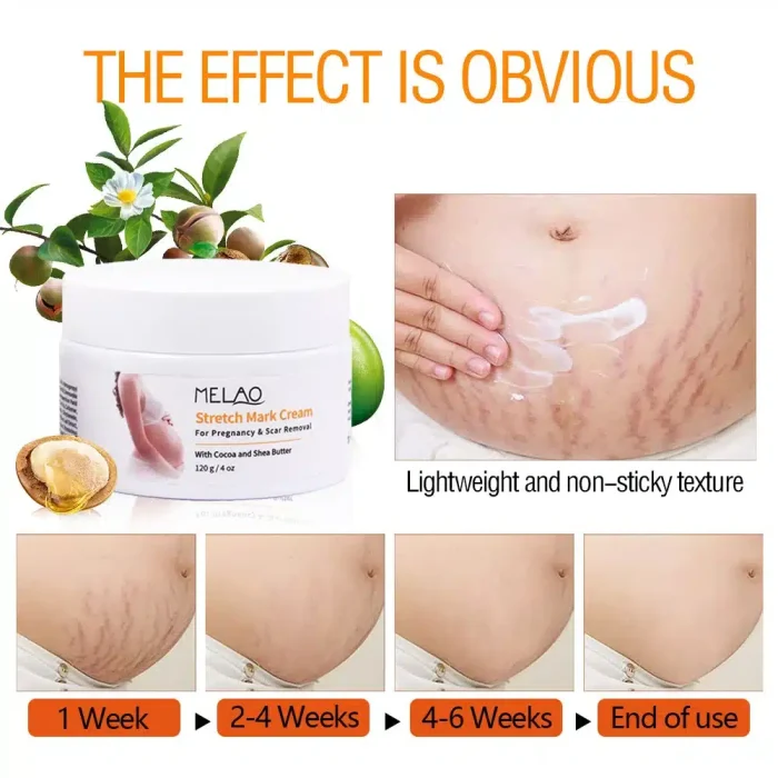 MELAO Stretch Mark Cream 120gm